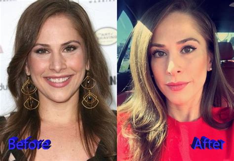 ana kasparian|ana kasparian before and after.